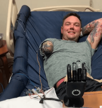 Alt Bionics Ryan Davis