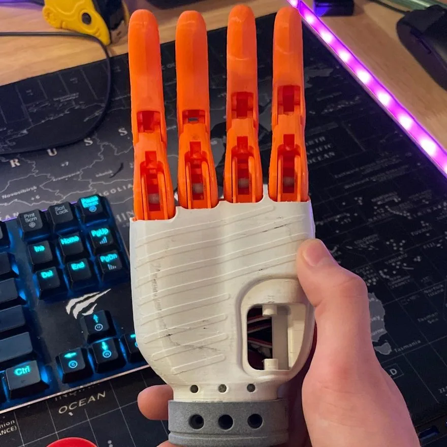 SLA 3D Printed Prosthetic Hand Prototype